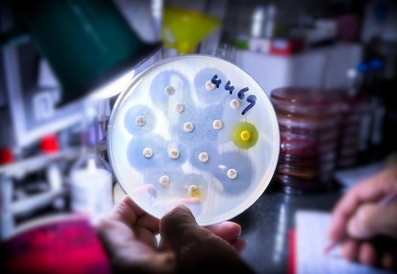 Scientists find key protein that could slow the spread of antibiotic resistance